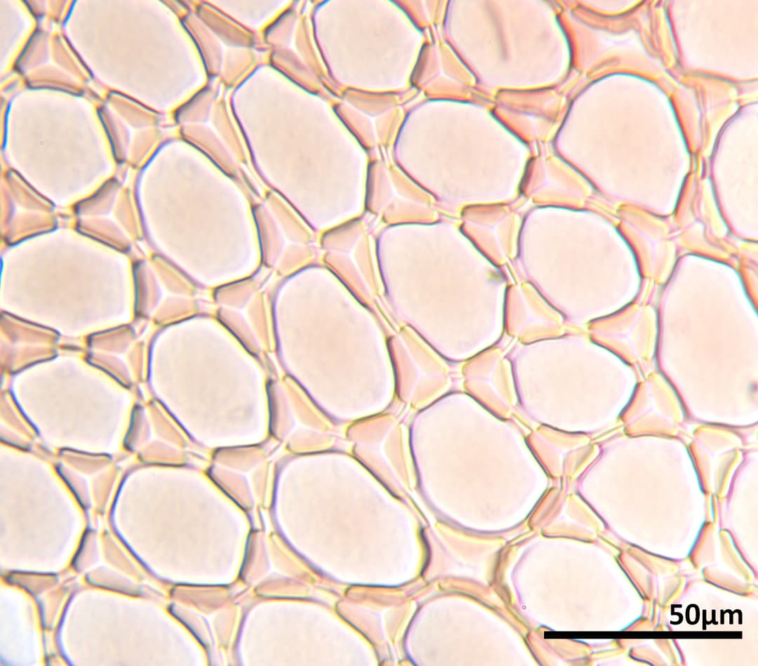 Median cells of the leaf-lobe of the liverwort genus Pleurozia