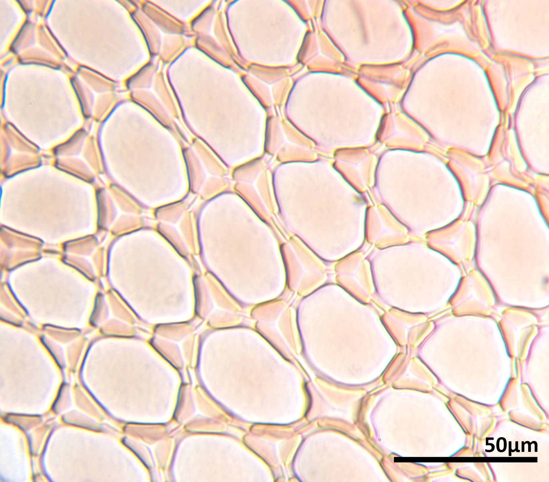 Median cells of the leaf-lobe of the liverwort genus Pleurozia